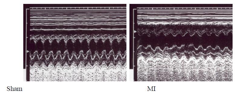 Echocardiographic data at 21 day after sham and MI rats.