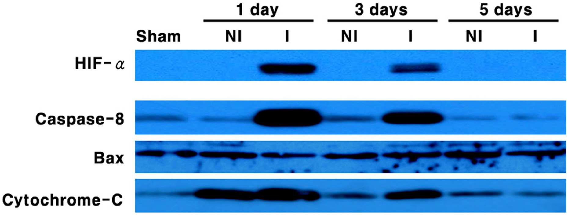 Expression of HIF-α, Caspase-8, Bax and Cytochrome-C by western blot analysis.