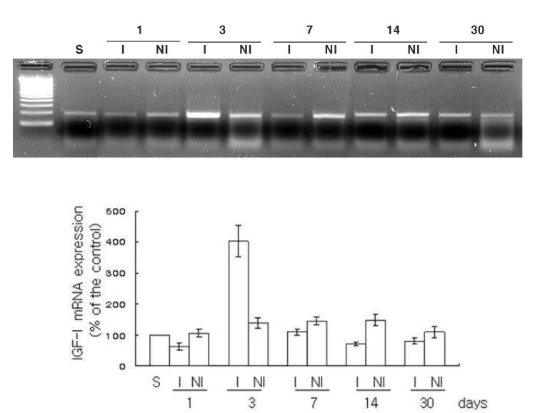 Left ventricle of the heart, Detection of IGF-I mRNA S, sham group; I, infarction of LV in MI group; I, non-infarction of LV in MI group