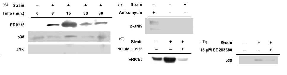 Simmons, A)인장자극에 의한 MAPK ERK1/2의 발현 양상, B) p-JNK의 발현 양상, C)ERK inhibitor U0126처리에 따른 ERK1/2의 발현 양상, p38 inhibitor SB203580 처리에 따른 p38 발현 양상
