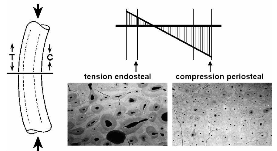 동물 실험 자극기의 원리, tensile stress 및 compressive stress를 가했을 때의 bone endosteal region 사진