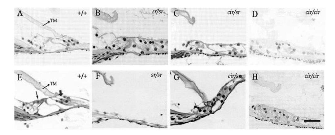 생후 18일(A-D)과 36일(E-H)의 각 유전형의 organ of Corti의 면역염색으로 본 형태. 정상마우스(A, E)에 비해 sr/sr, cir/sr, cir/cir 의 마우스가 시간이 지남에 따라 hair cell이 점차적으로 퇴화하고 있음을 보여줌.
