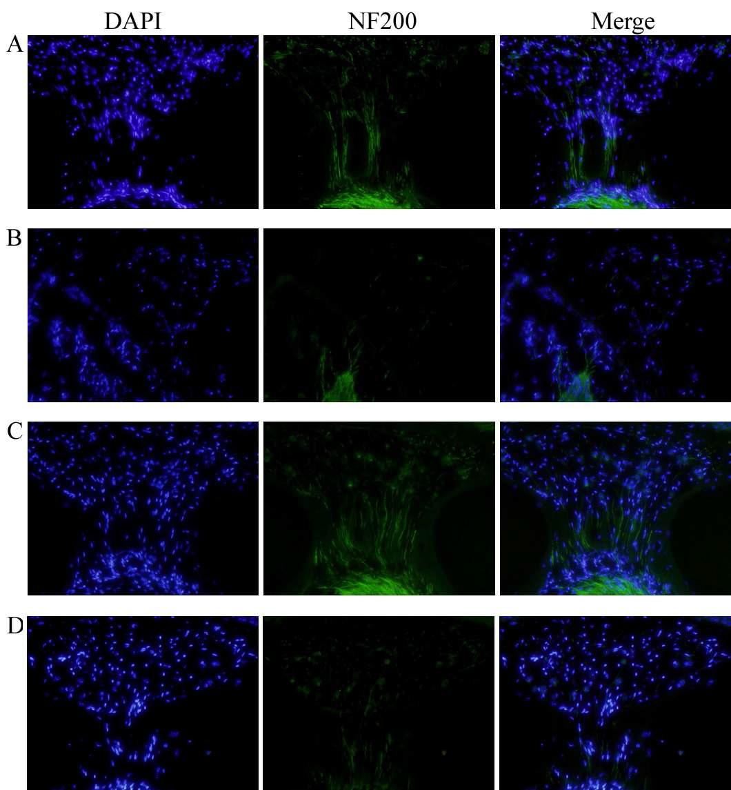 Analysis of cellularity in the spiral ganglion neurons (SGNs) in the cochleas of the adult wild type (A), cir/cir (B), cir/cir-tgA (C) and cir/cir-tgB (D). The SGNs were immunostained with anti-neurofilament 200 (NF200) antibodies (green). Nuclei are visualized with DAPI (blue). Right images are merged images from the left (DAPI) and center (anti-NF200). Reduced SGN cellularity and the neurite formation were shown in the homozygous cir/cir mouse compared with the wild type. The cir/cir-tgA mice showed the recovery in the SGN cellularity and the formation of neurites (C) whereas cir/cir-tgB mice did not exhibit the recovered morphology in the cochlea (D).