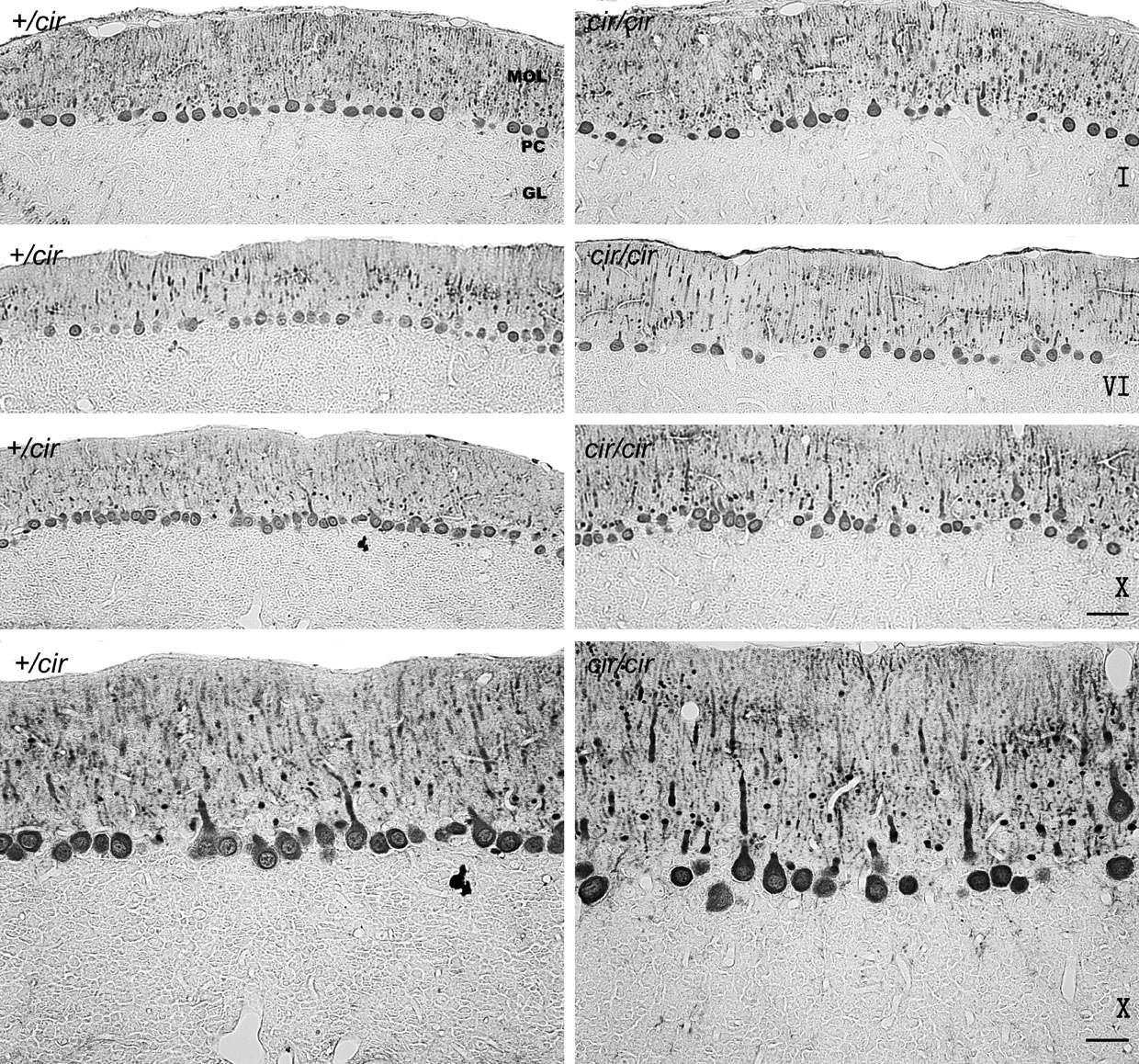 소뇌 lobule 관상단면 (I, VI 및 X번 소엽) Calbindin D-28k 면역염색사진.