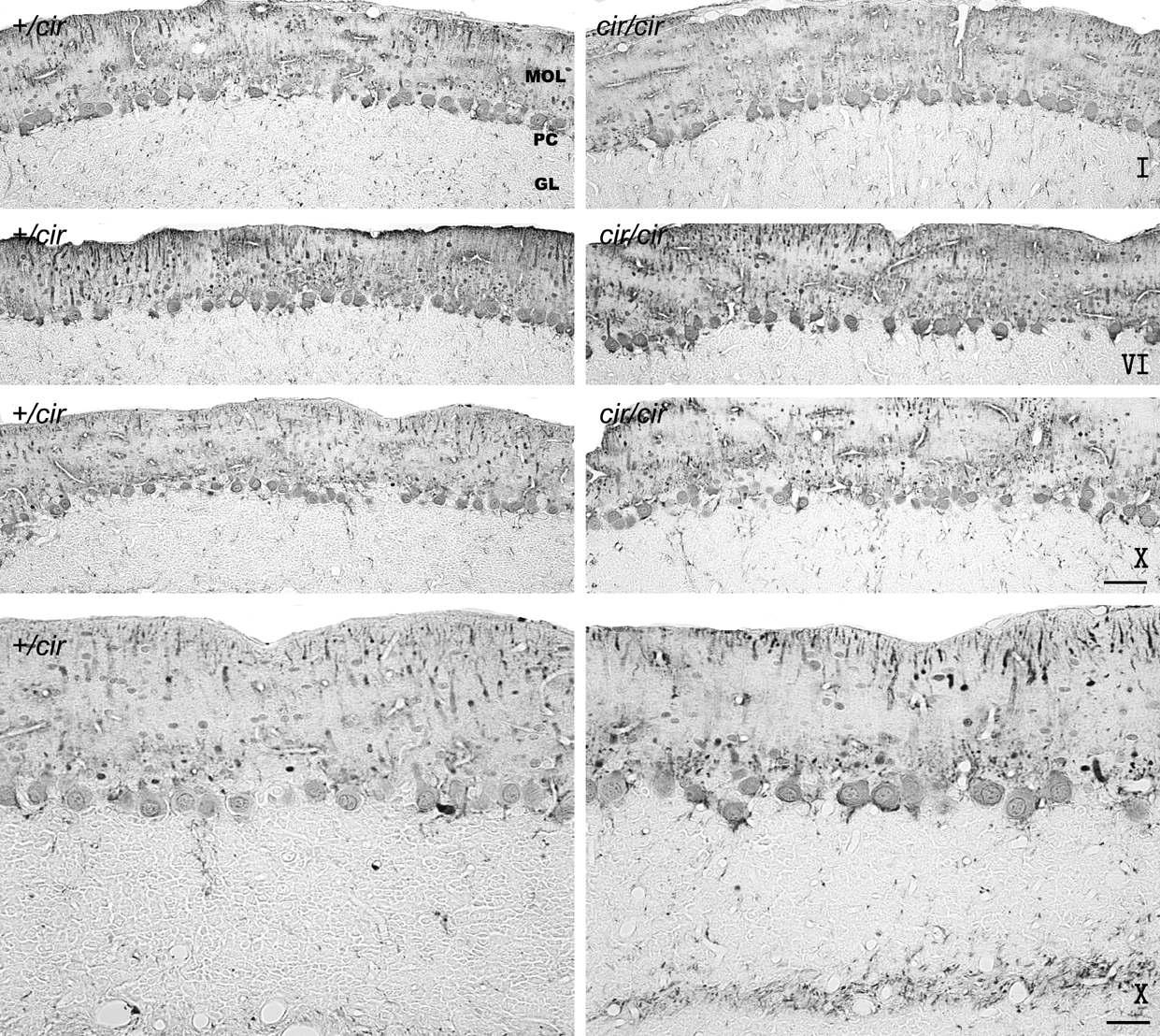 소뇌 lobule 관상단면 (I, VI 및 X번 소엽) Parvalbumin 면역염색사진.