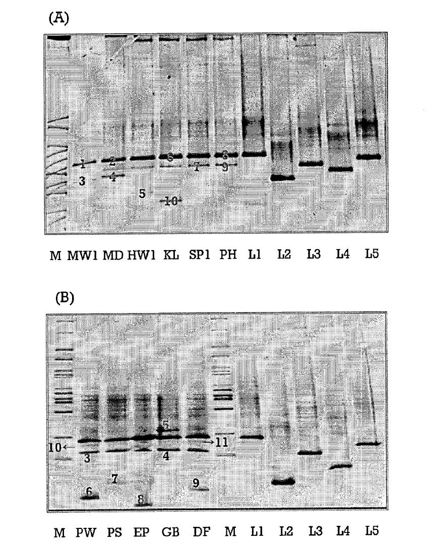 DGGE profiles.