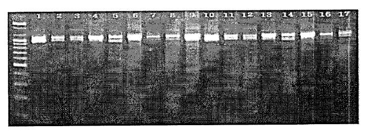 토양시료의 total DNA에 대한 fungal-specific PCR Primers를 사용한 증폭 결과.