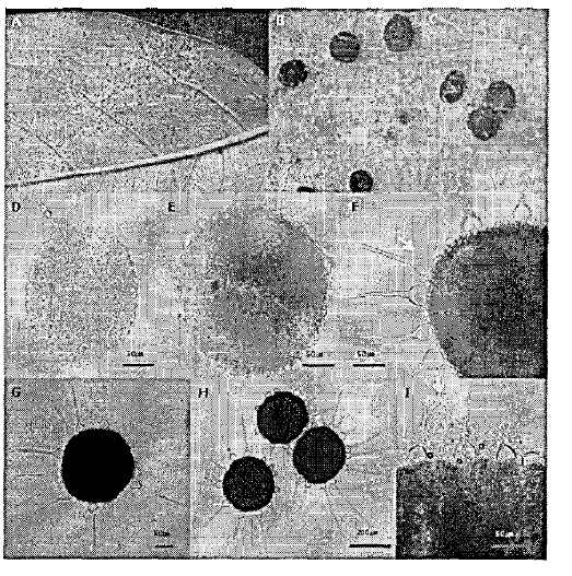 Powdery mildew symptoms and the morphology of the causal fungus, Phyllactinia sp. on adaxial leaf of Chionanthus retusus