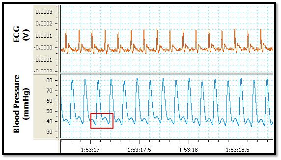 정상적으로 수집된 혈압 파형