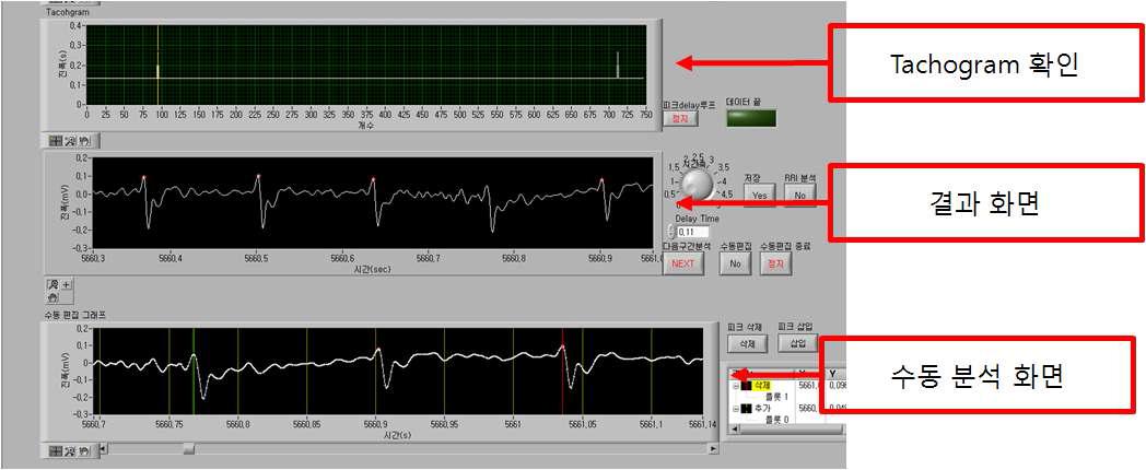 ECG R-peak 분석화면 (2)