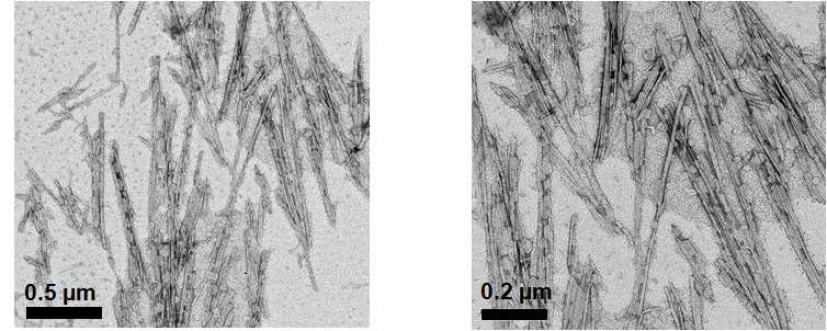 산가수분해를 통하여 제조되어진 박테리아 나노셀룰로오스의 투과전자현미경 사진
