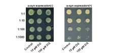α-synuclein-GFP 과발현 yeast에서 DQ에 의한 amyloid 분해와 세포독성