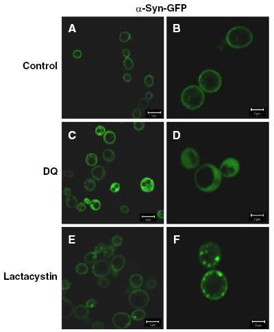 Yeast에서의 DQ와 lactacystain 처리에 따른 α-synuclein-GFP 발현 분포