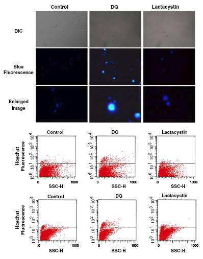 α-synuclein-GFP 발현 yeast에서 DQ와 lactacystain 처리에 따른 Hoechst 염색결과