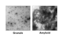 철 이온에 의해 유도되어진 amyloid β protein granular 형태와 PcTS에 의한 amyloid 생성물