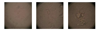 각 표면에서 자라는 세포의 경향성. 일반 세포배양 시스템 표면(왼쪽), 아밀로이드 표면(가운데), 콜라겐 표면(오른쪽)