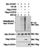 α-Synculein 분해 및 응집에 관여하는 세포 내 단백 Ubiquitination-Proteaomse 시스템 조절