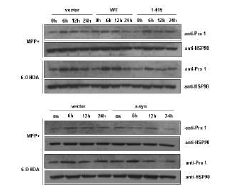 Peroxiredoxin1의 발현 패턴