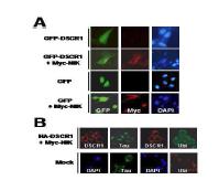 α-Synuclein 및 DSCR1의 상호 작용에 의한 단백 응집 조절 효과