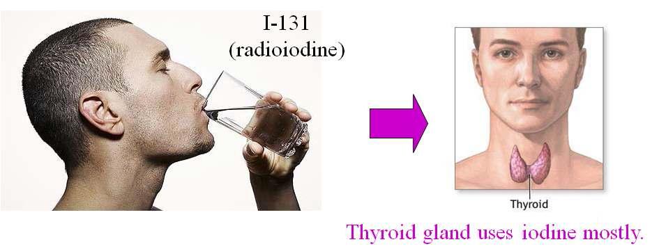 Study of activity of thyroid using I-131