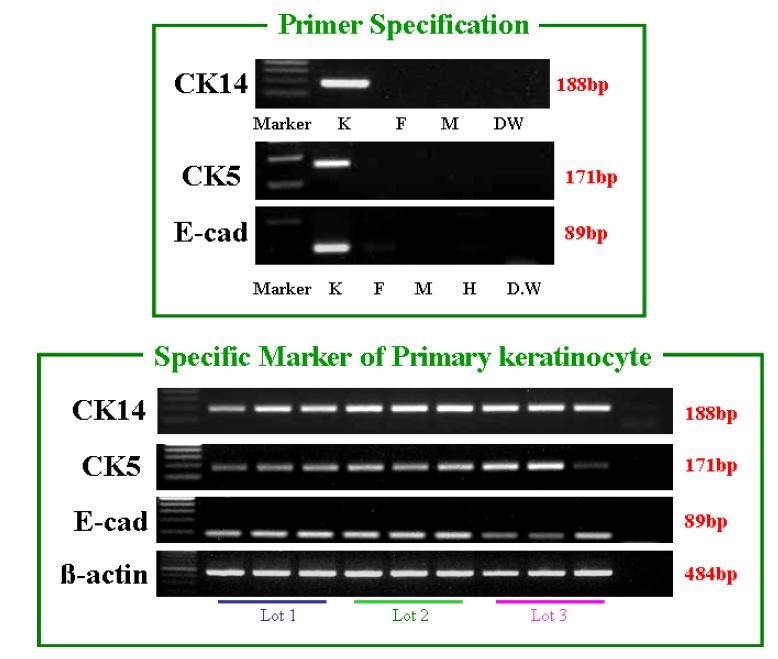 특성화 단백질 인자 마커를 이용한 RT-PCR 피부각질세포 확인결과