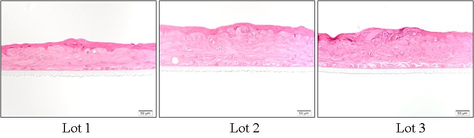 여러 조직으로부터 분리 배양된 피부각질세포를 층분화 유도 6일후(서브머즈 3일+ 공기노출 3일)에 피부각질세포 미분화표지자인 사이토케라틴 14 염색