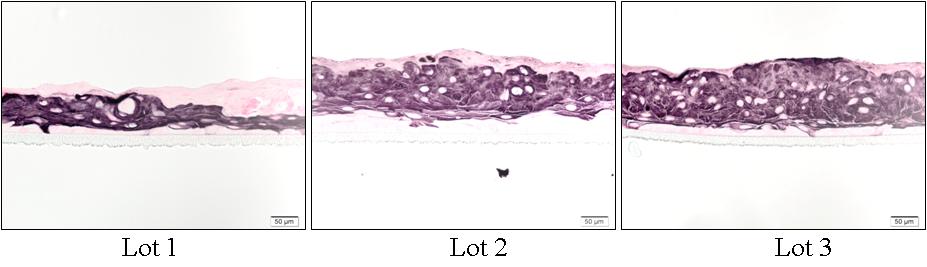 여러 조직으로부터 분리 배양된 피부각질세포를 층분화 유도 6일후(서브머즈 3일+ 공기노출 3일)에 피부각질세포 분화표지자인 사이토케라틴 10 염색