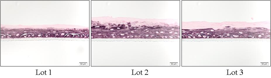 여러 조직으로부터 분리 배양된 피부각질세포를 층분화 유도 8일후(서브머즈 3일+ 공기노출 5일)에 피부각질세포 미분화표지자인 사이토케라틴 14 염색