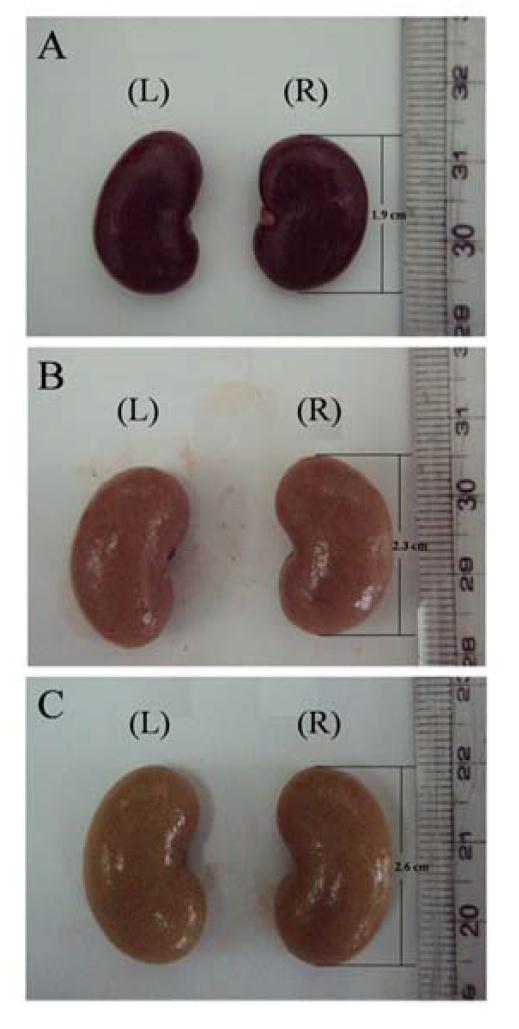 Gross morphology of the kidneys in Sprague Dawley rats treated with the mixture of melamine and cyanuric acid (MC).