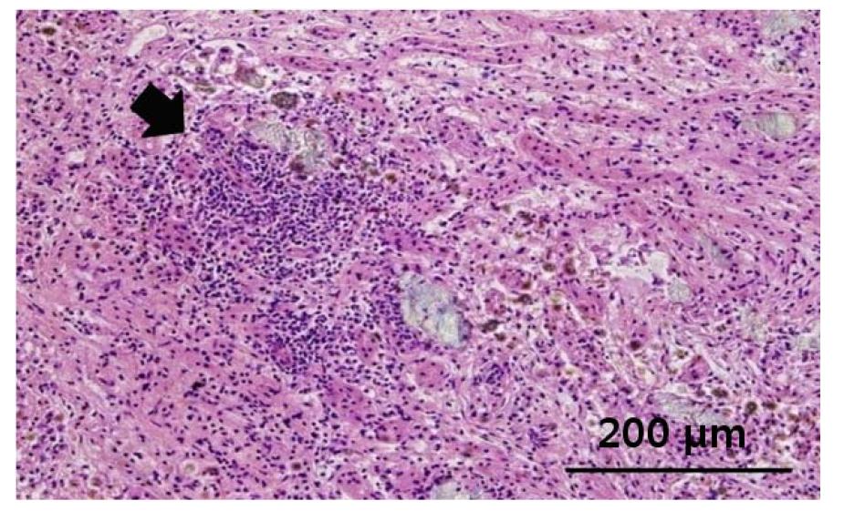 Photographs of MC mixture treated rat kidneys.