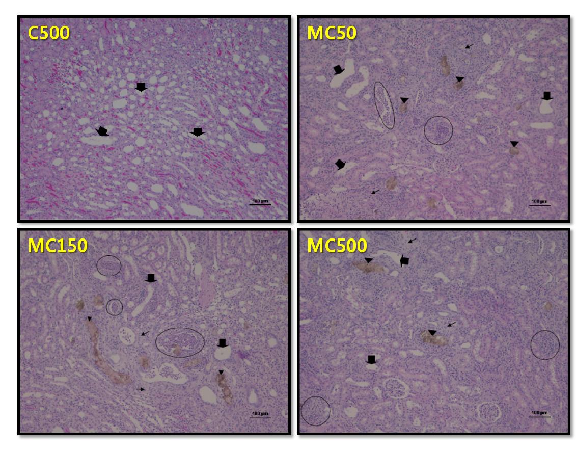 Renal histologic diagnosis after 8 days repeated dose of melamine, cyanuric acid and the mixture in SD rats.