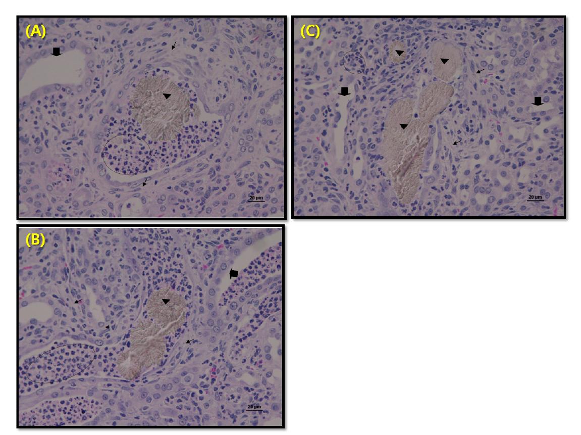 Renal histologic diagnosis after 8 days repeated dose of melamine-cyanuric acid mixtures in SD rats. (A) MC50, (B) MC150, (C) MC500.