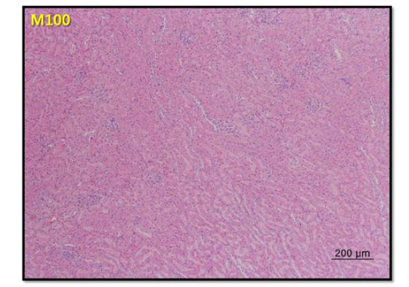 Renal histologic diagnosis in male SD rats following 7-day repeated oral exposure to melamine at 100 mg/kg/day.