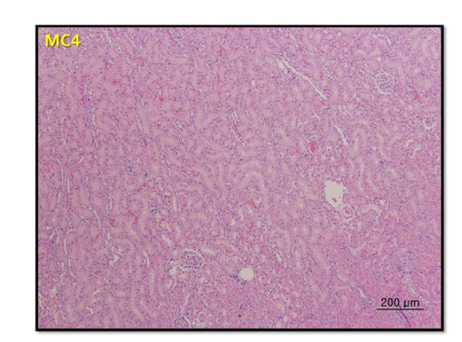 Renal histologic diagnosis in male SD rats following 7-day repeated oral exposure to melamine-cyanuric acid mixture at 4 mg/kg/day.