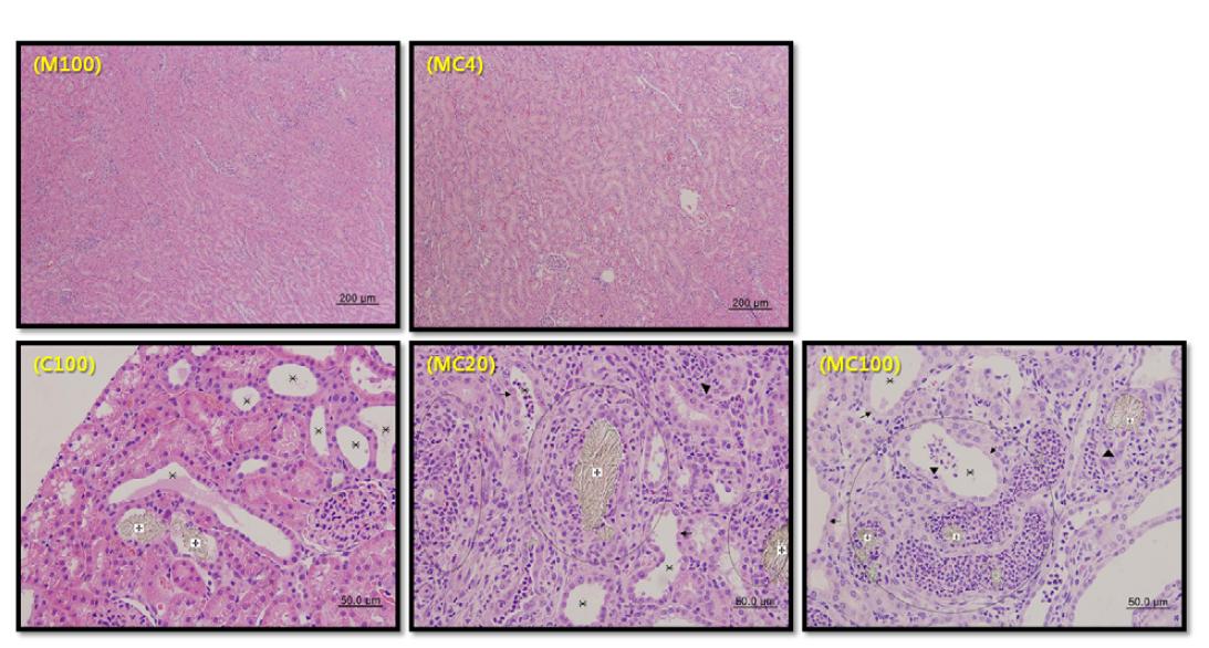 Summary of renal histologic diagnosis.