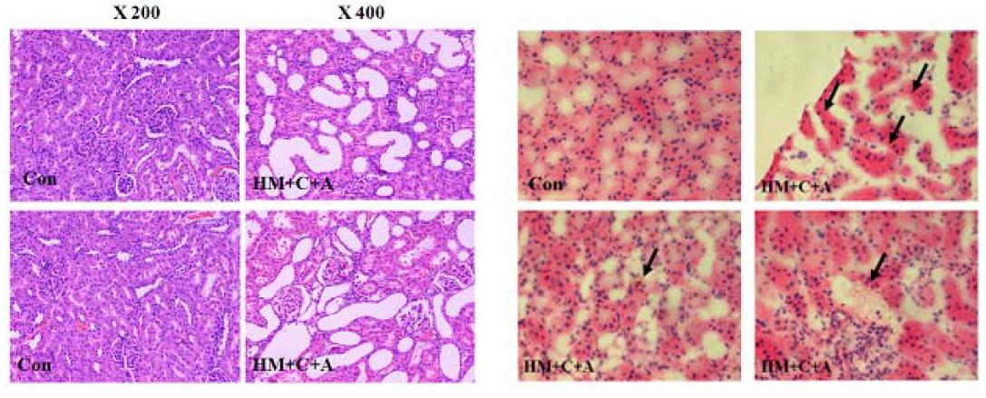 Histological examination of the kidney after 50 days of treatment with melamine and cyanuric acid in Sprague-Dawley rats.