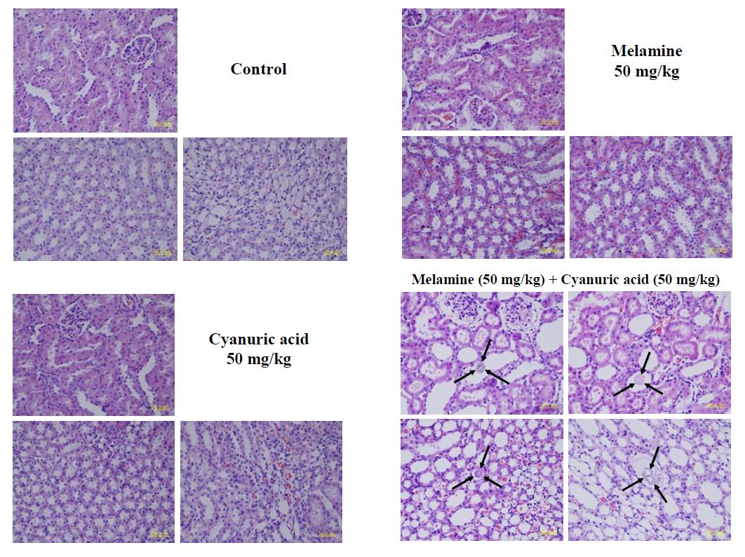 멜라민 및 시아눌산 병용처리에 의한 신장에서의 결석 형성