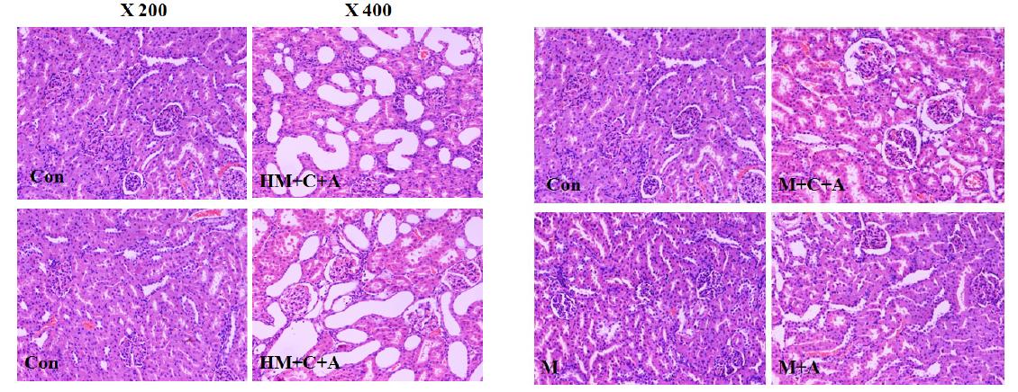 Histological examination of the kidney after 50 days of treatment with melamine and cyanuric acid in Sprague-Dawley rats.