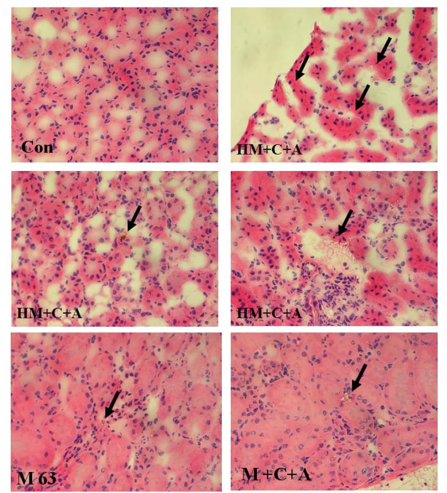 Examination of cyrstal formation in the kidney after 50 days of treatment with melamine and cyanuric acid in Sprague-Dawley rats.