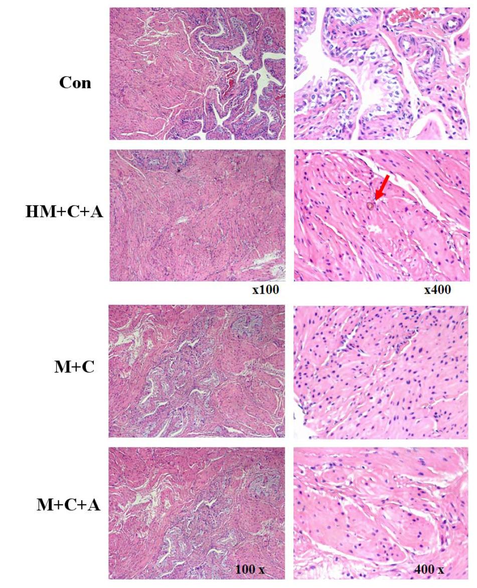 Histological examination of the urinary bladder after 50 days of treatment with melamine and cyanuric acid in Sprague-Dawley rats.