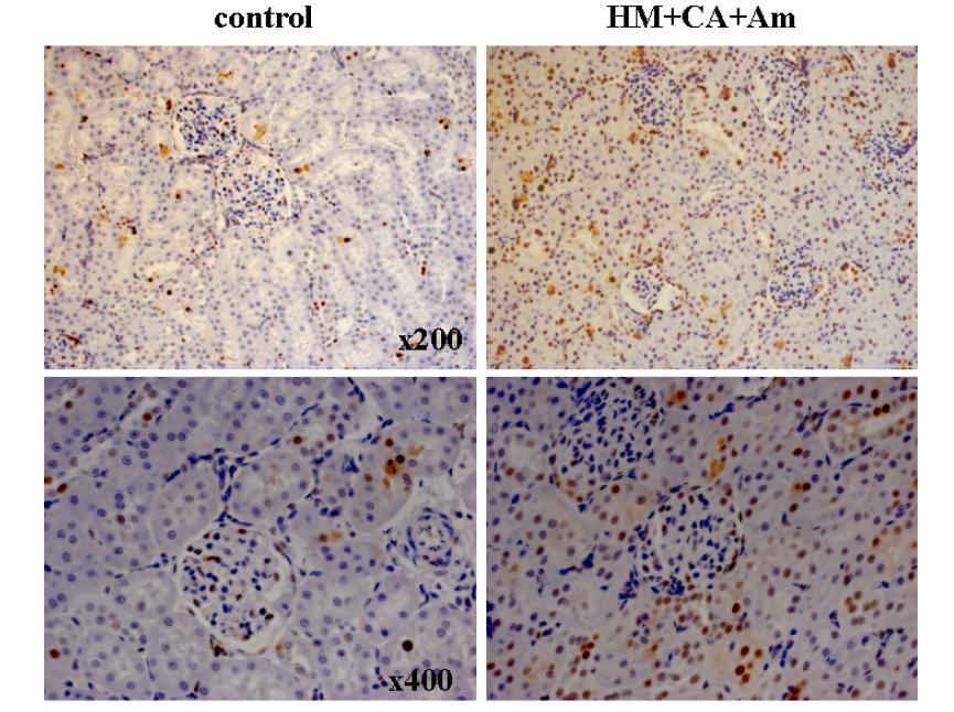 Immunohistochemical analysis of K-67 in the kidney after 50 days of treatment with melamine and cyanuric acid in Sprague-Dawley rats.