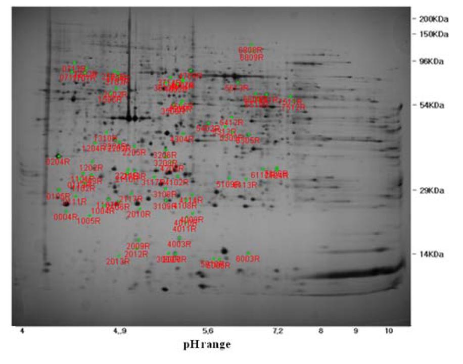 Silver stained 2D gel map showing positions of putative markers identified by differential expression.