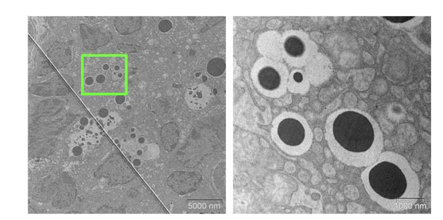 Spleen of mice at 28 day after injection of 5 mg/kg of HA-NP.