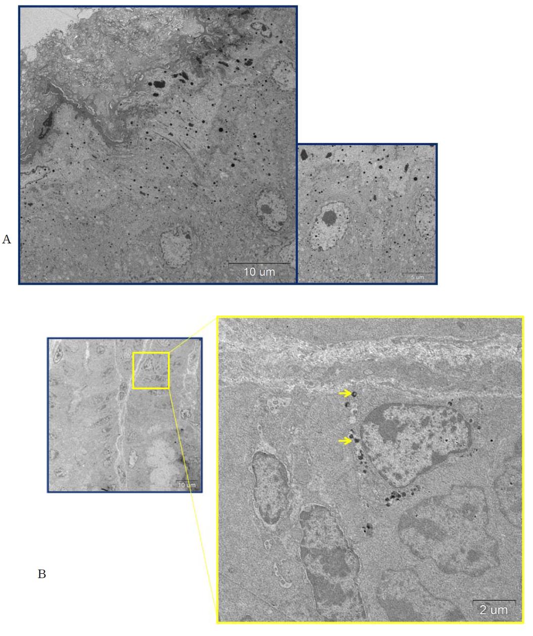 Stomach of mice at 1(A) and 28(B) days after oral administration of 200 mg/kg of ZnO. ZnO nanoparticles observed in the cytoplasm of a basal cell of surface mucous cells