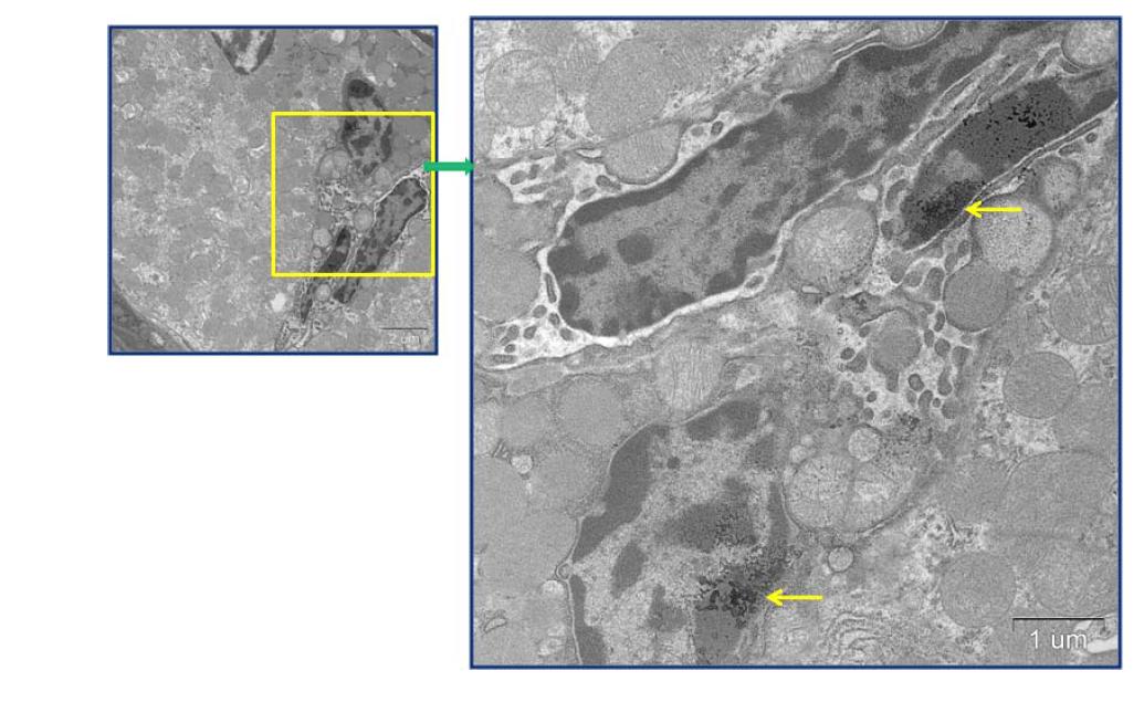 Small intestine of mice at 28 day after oral administration of 200 mg/kg of ZnO