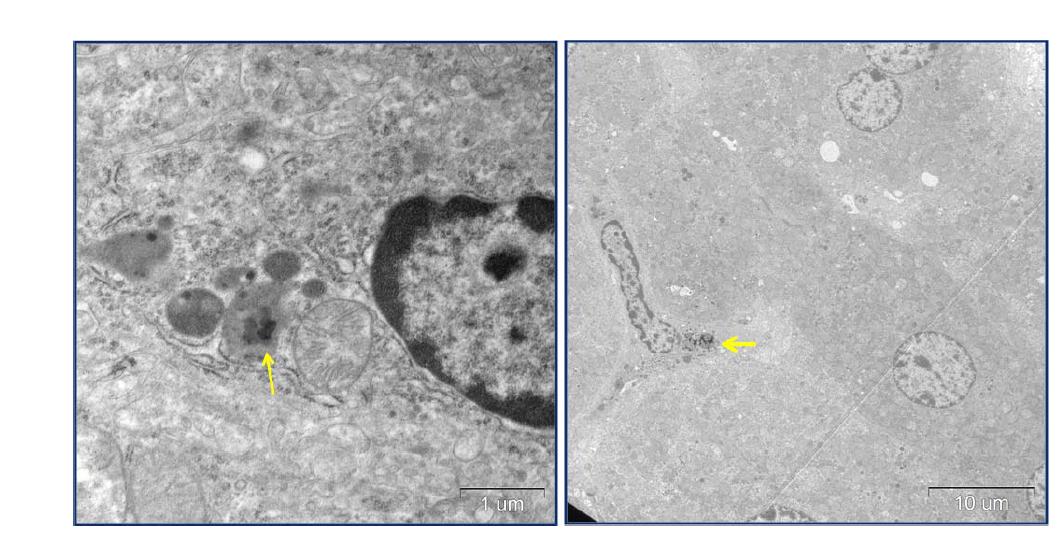 Mouse livers at 1 day after oral administration of 200 mg/kg of ZnO. Left : ZnO in lysosome of Kupffer cell (5000x), Right : ZnO in the cytoplasm of Kupffer cell (630x)