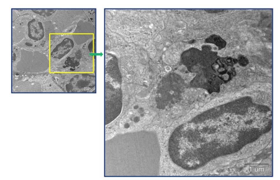 Zn nanoparticle infiltrated in the macrophage of spleen in mice at 28 day after oral administration of 200 mg/kg of ZnO