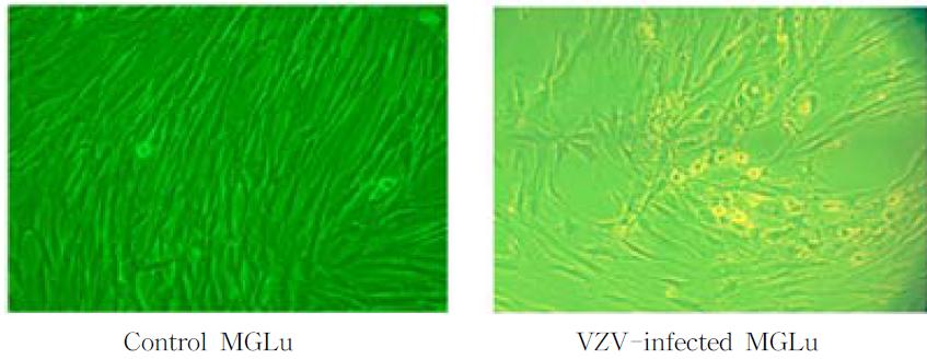 Control MGLu and VZV-infected MGLu cells