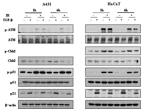 ATM. A431과 HaCaT에서 TGF-beta1 처리에 따른 방사선에 의한 DNA 손상 및 복구에 관여 하는 단백질들의 활성화의 변화.