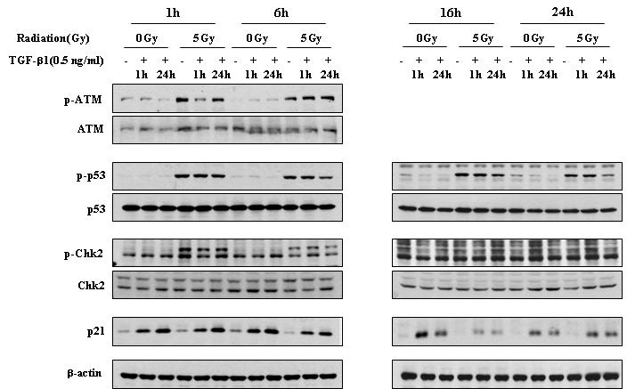 A431에서 TGF-beta 처리 시간에 따른 방사선에 의한DNA 손상 및 복구에 관여하는 단백질들의 활성화의 변화.